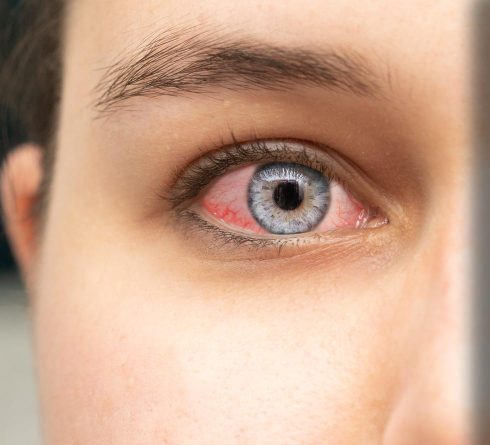 emergency eye care